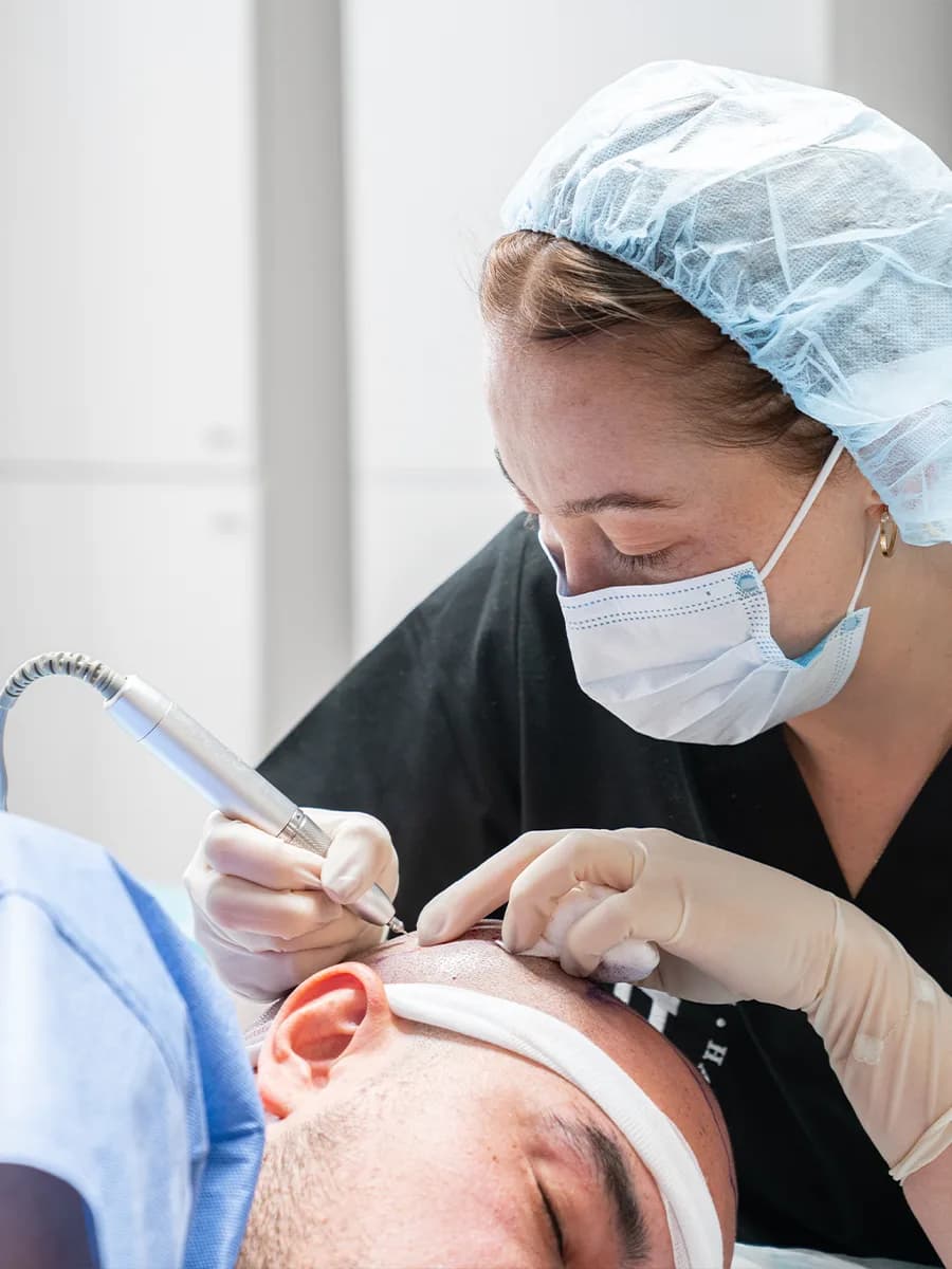 FUE Hair Transplant modern technique, natural result