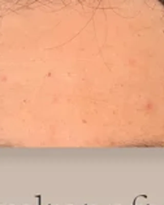 Before hair transplant, man