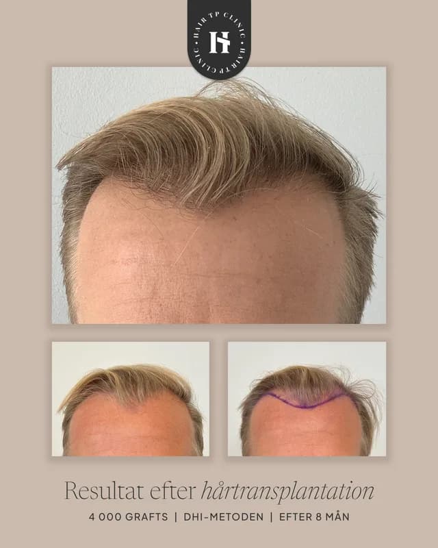 Före och efter, man, resultat 12 av 21